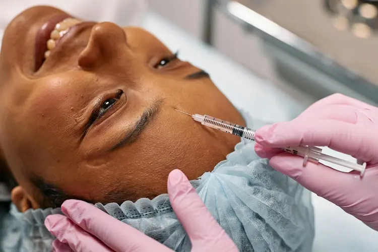 Botox behandeling in Amsterdam: dit zijn de belangrijkste punten